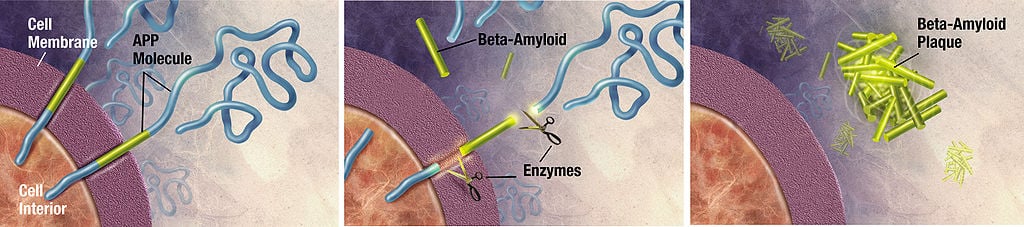 Enzymes act on the APP (Amyloid precursor protein) and cut it into fragments of protein, one of which is called beta-amyloid and is crucial in the formation of senile plaques in Alzheimer. Enzymes act on the APP (Amyloid precursor protein) and cut it into fragments of protein, one of which is called beta-amyloid and is crucial in the formation of senile plaques in Alzheimer. (Courtesy of derivative work: Garrondo (talk). ADEAR: "Alzheimer's Disease Education and Referral Center, a service of the National Institute on Aging.", Public domain, via Wikimedia Commons
