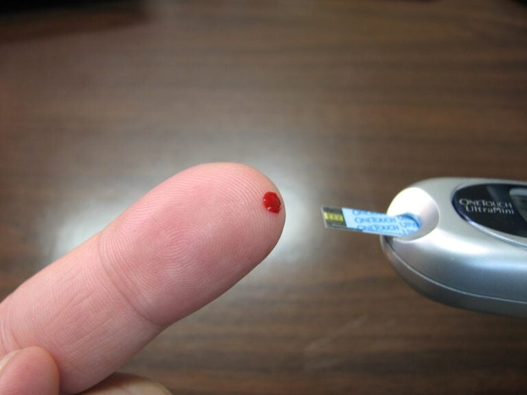 diabetes, blood, glucose test