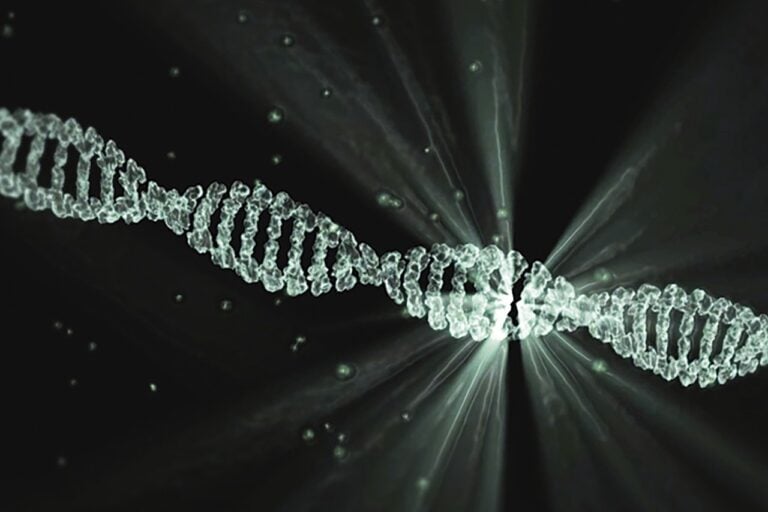 An Alzheimer's Gene