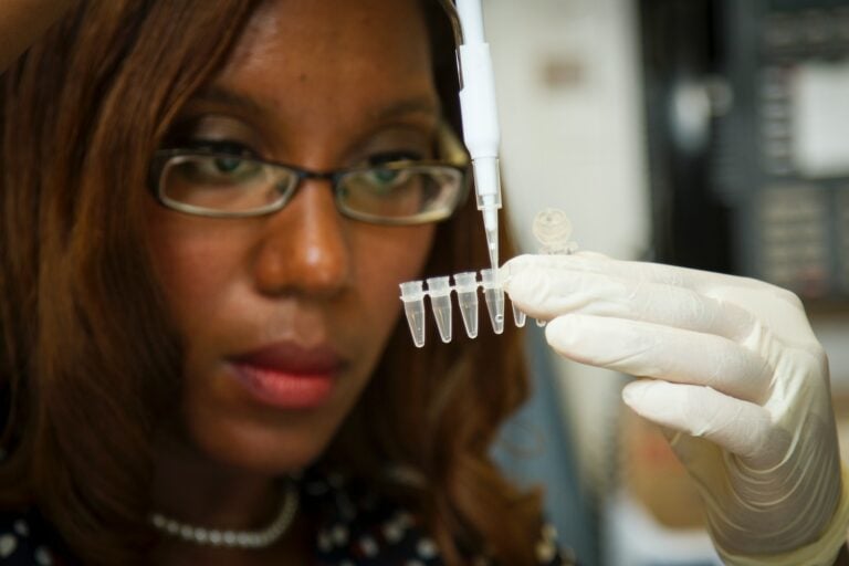 woman in black and white floral shirt holding saliva test