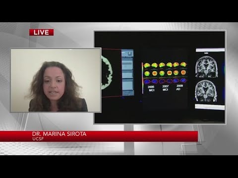 Scientist using A.I. to detect Alzheimer's