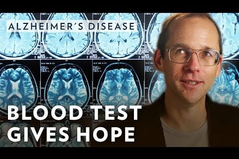 Alzheimer's Blood Test Gives Hope
