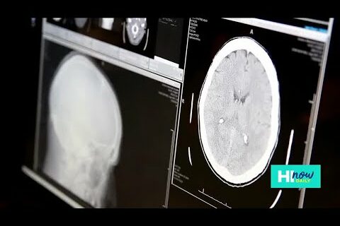 Brain Scan