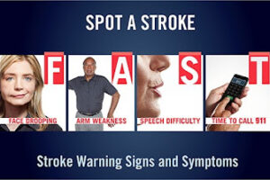 Stroke Warning Signs