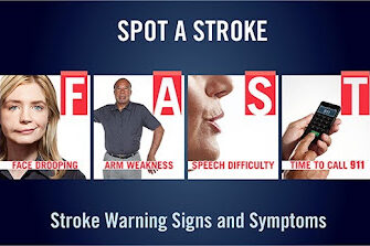 Stroke Warning Signs