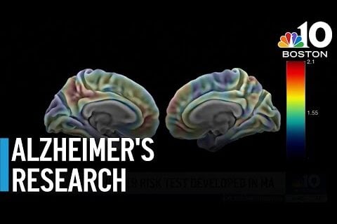 Alzheimer's Research: 2 Brains