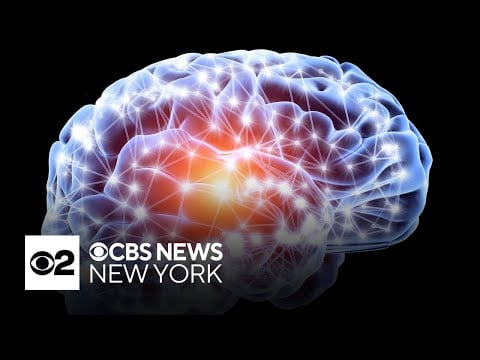 Illustration of Active Brain